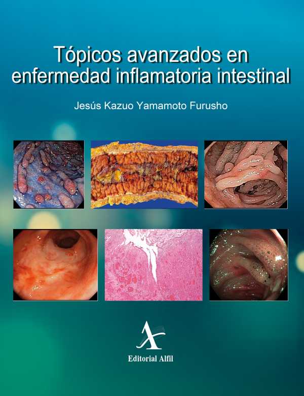 bw-toacutepicos-avanzados-en-enfermedad-inflamatoria-intestinal-editorial-alfil-9786077416128