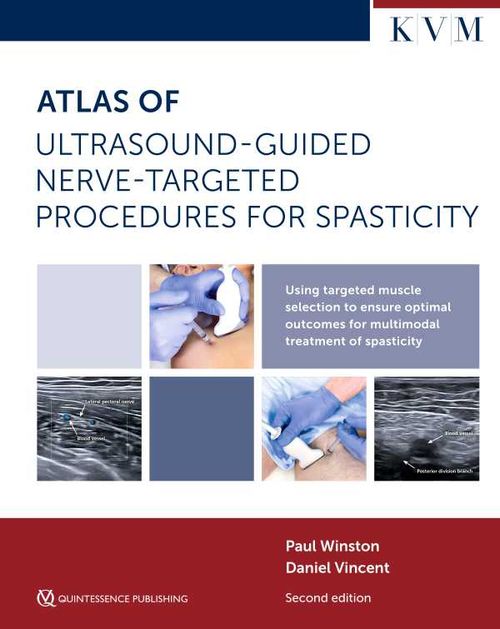 Atlas of UltrasoundGuided NerveTargeted Procedures for Spasticity