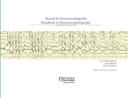 Manual de electroencefalografia