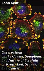 bw-observations-on-the-causes-symptoms-and-nature-of-scrofula-or-kings-evil-scurvy-and-cancer-good-press-4064066177447