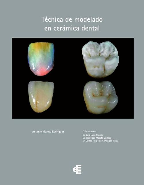 Tecnica de modelado en ceramica dental