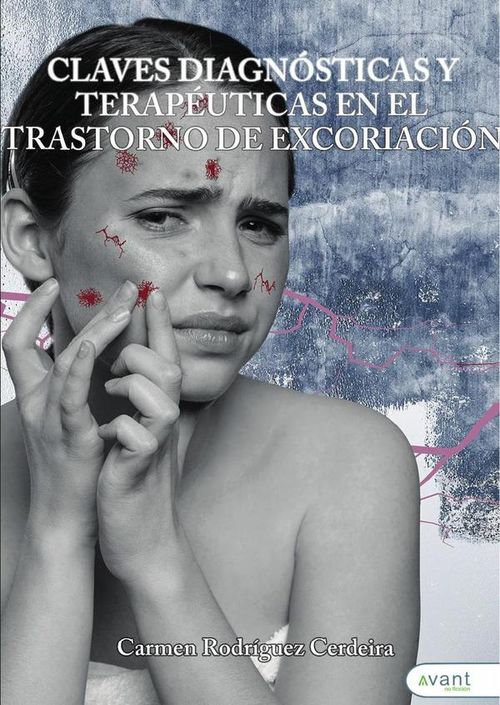 Claves diagnosticas y terapeuticas en el trastorno de excoriacion