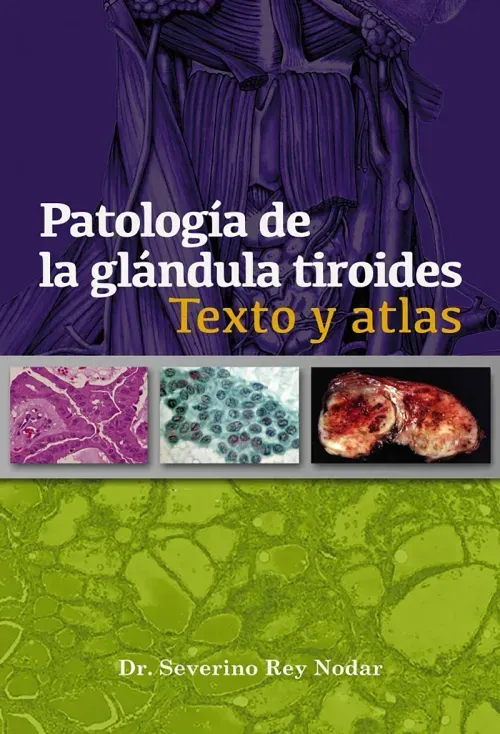 Patologia de la glandula tiroides