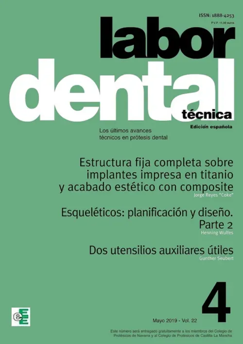 Labor Dental Tecnica Vol22 Mayo 2019 nº4