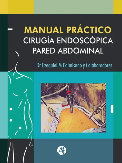 Manual Practico de Cirugia Endoscopica de la Pared Abdominal