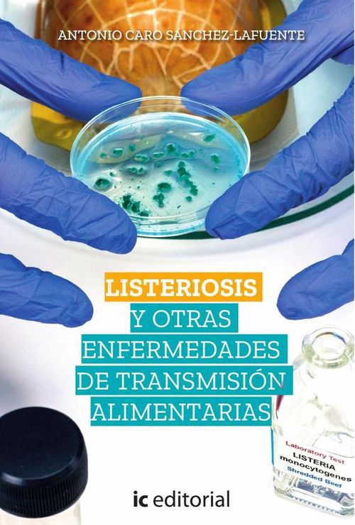 Listeriosis y otras enfermedades de transmision alimentarias