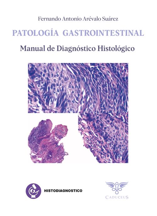 Histodiagnostico Patologia gastrointestinal