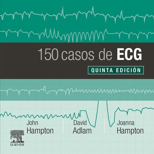 150 casos de ECG 5ª ed
