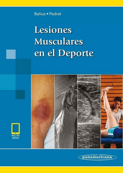 BALIUSLesiones Musculares en el Depe