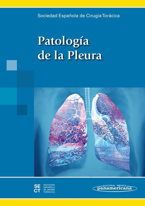 SECTPatologÆa de la Pleura