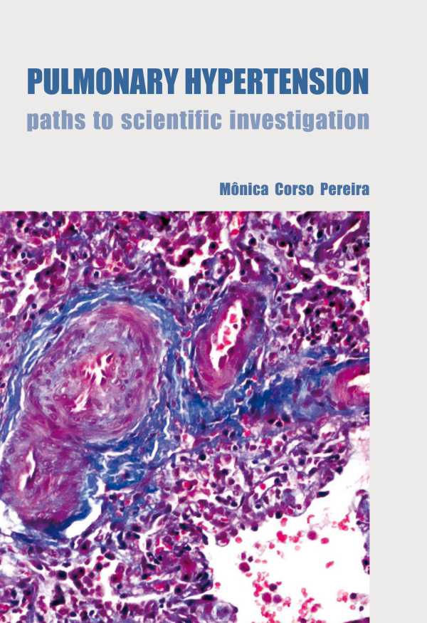 bw-pulmonary-hypertension-editora-da-unicamp-9788526817876
