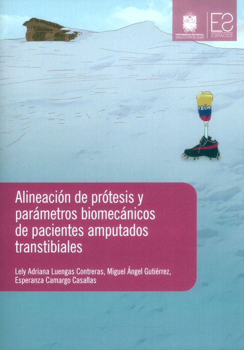 Alineación de prótesis y parámetros biomecánicos de pacientes amputados transtibiales