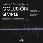 OCLUSION SIMPLE Y SU APLICACION EN LA REHABILITACION ADHESIVA DEL DESGASTE DENTA