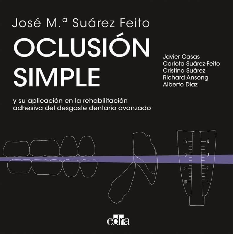 OCLUSION SIMPLE Y SU APLICACION EN LA REHABILITACION ADHESIVA DEL DESGASTE DENTA