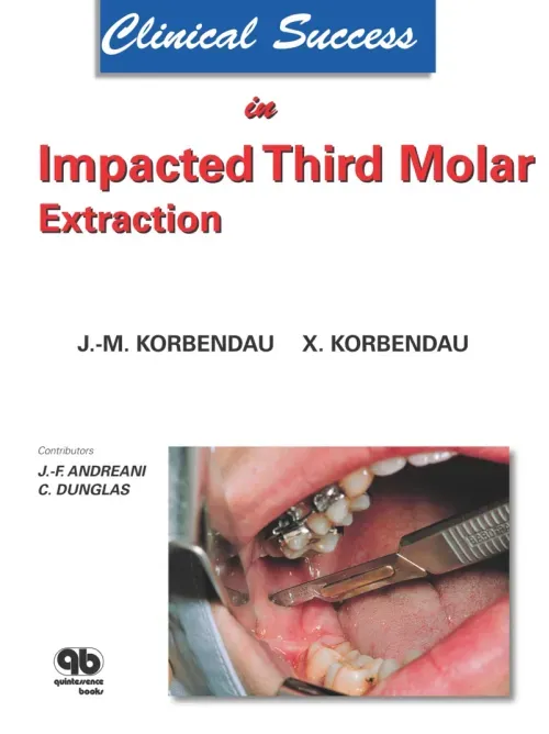 Clinical Success in Impacted Third Molar Extraction