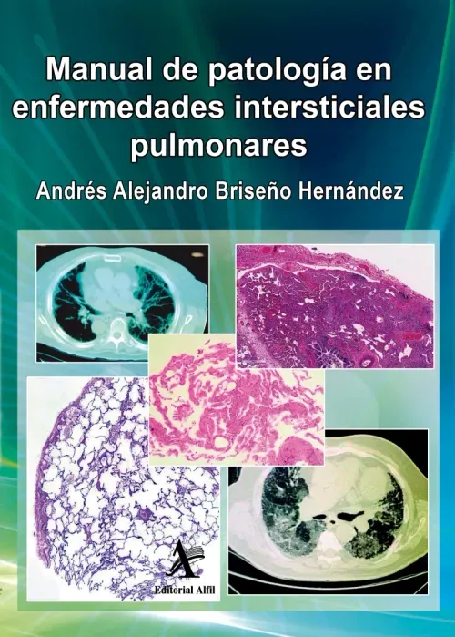 Manual de patologia en enfermedades intersticiales pulmonares