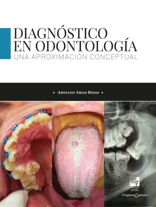 Diagnostico en odontologia Una aproximacion conceptual