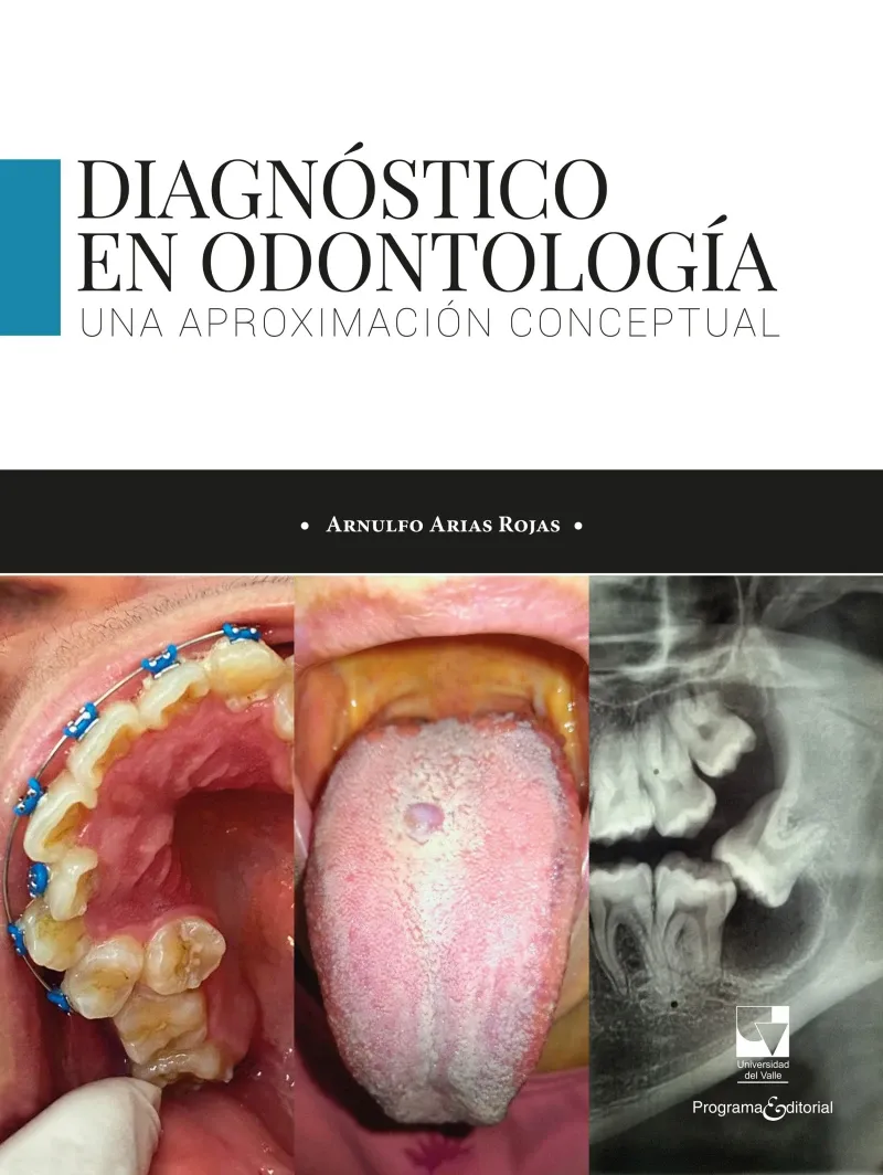 Diagnostico en odontologia Una aproximacion conceptual