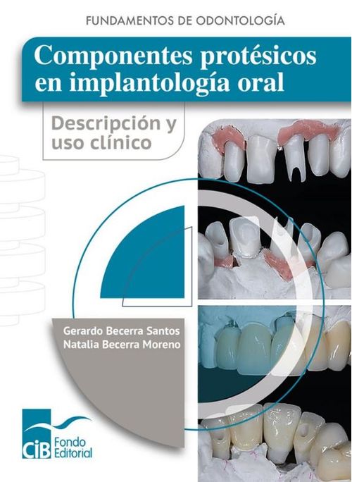 Componentes protésicos en implantología oral