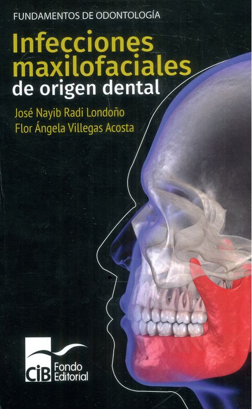 Infecciones maxilofaciales de origen dental