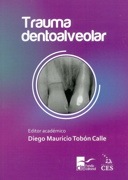 Trauma dentoalveolar