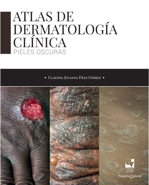 Atlas de dermatología clínica