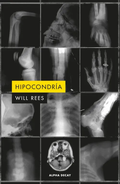 Hipocondria