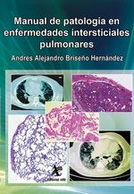 Manual de patolog237a en enfermedades intersticiales pulmonares