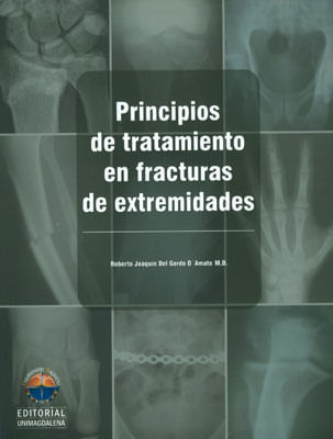 Principios de tratamiento en fracturas de extremidades